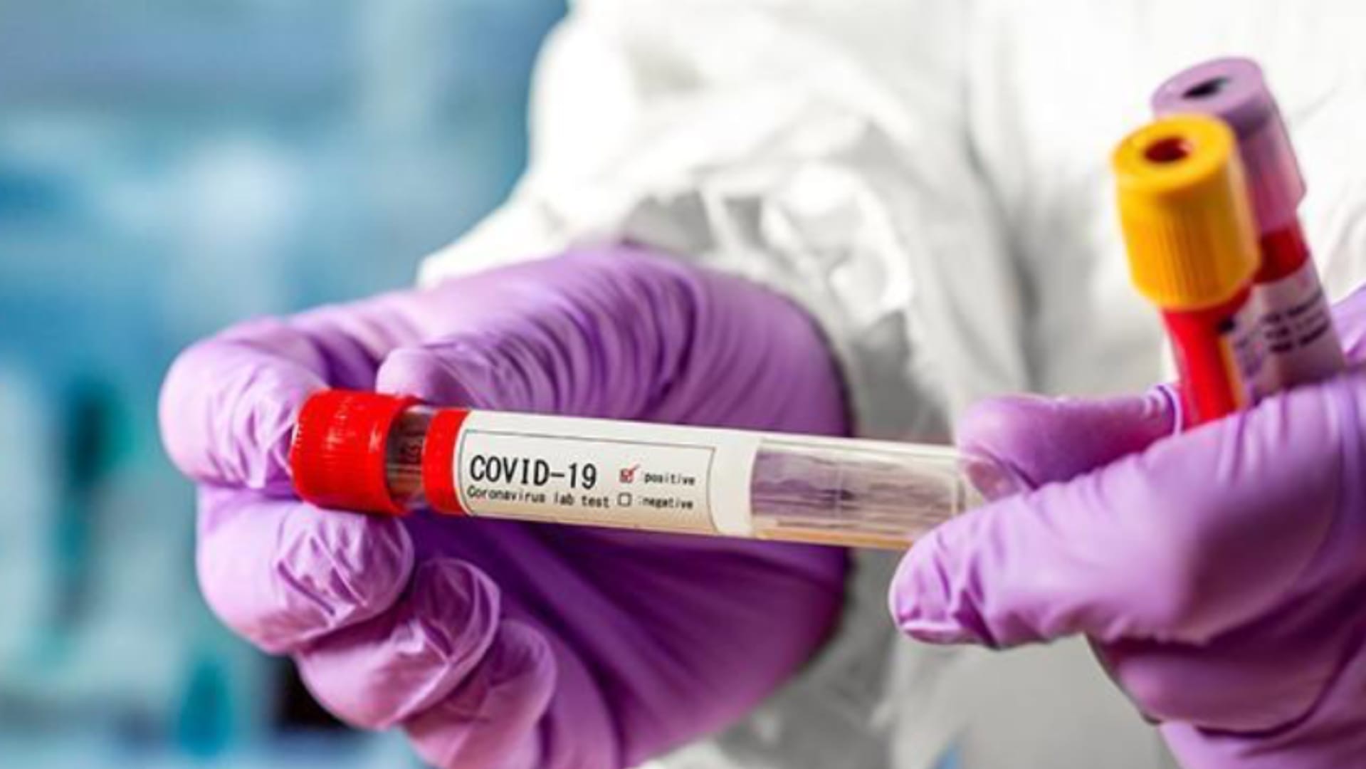 Анализы на антитела covid19 в поликлинике "Диамед"